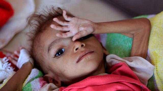 Le Yémen, un "enfer sur terre" pour les enfants