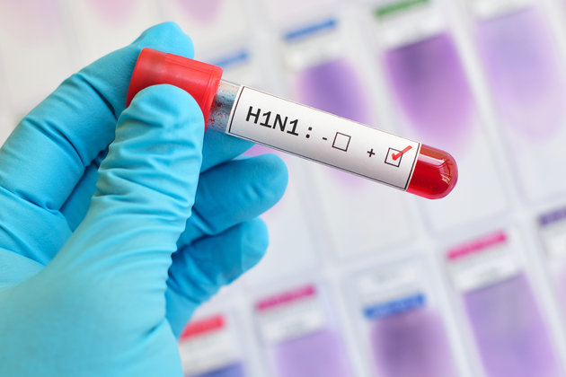 Grippe A/H1N1 : Cafouillage maladif