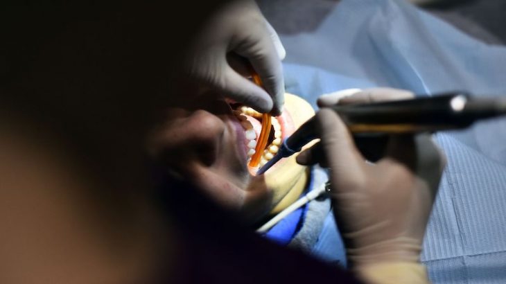 Les médecins dentistes s’insurgent contre la création d'écoles de formation "denturologue"