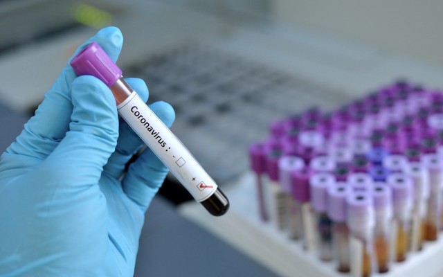 Coronavirus : 31 nouveaux cas et un décès de plus