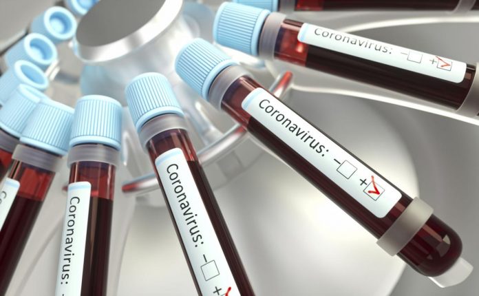 Coronavirus : Le Maroc fait un bond à 437 cas, un nouveau décès