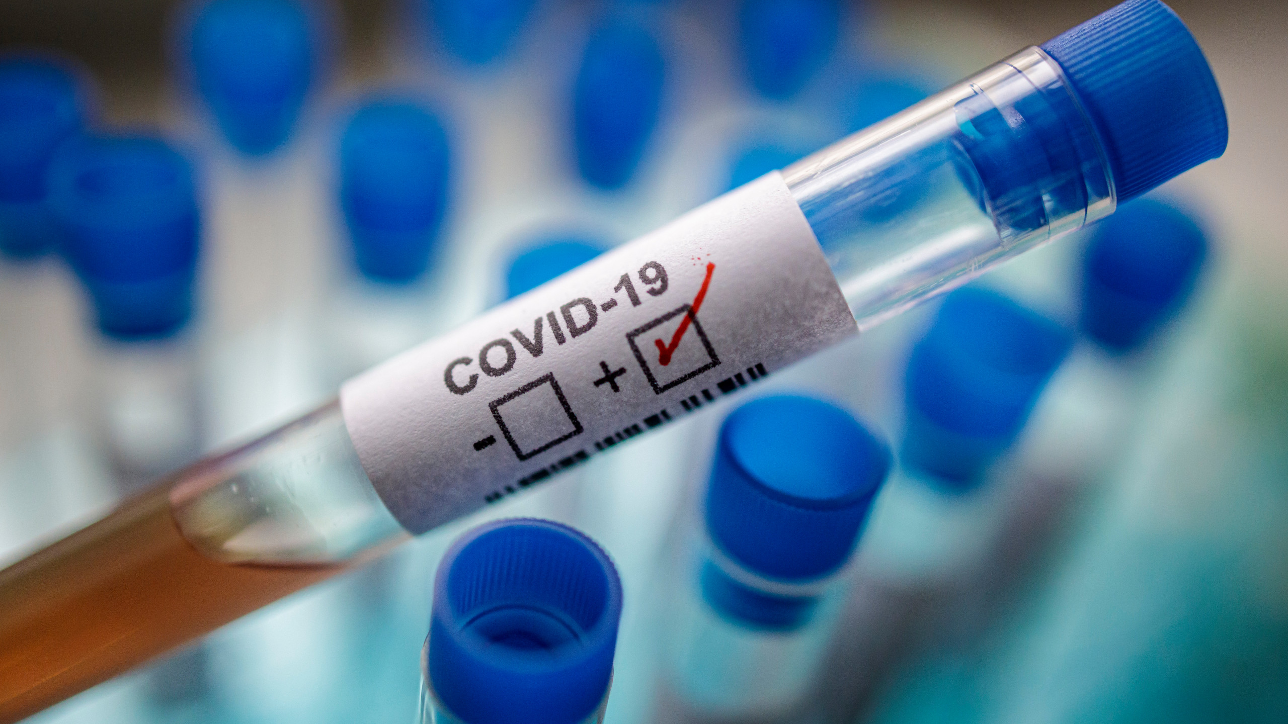 Coronavirus : 92 nouveaux cas confirmés au Maroc