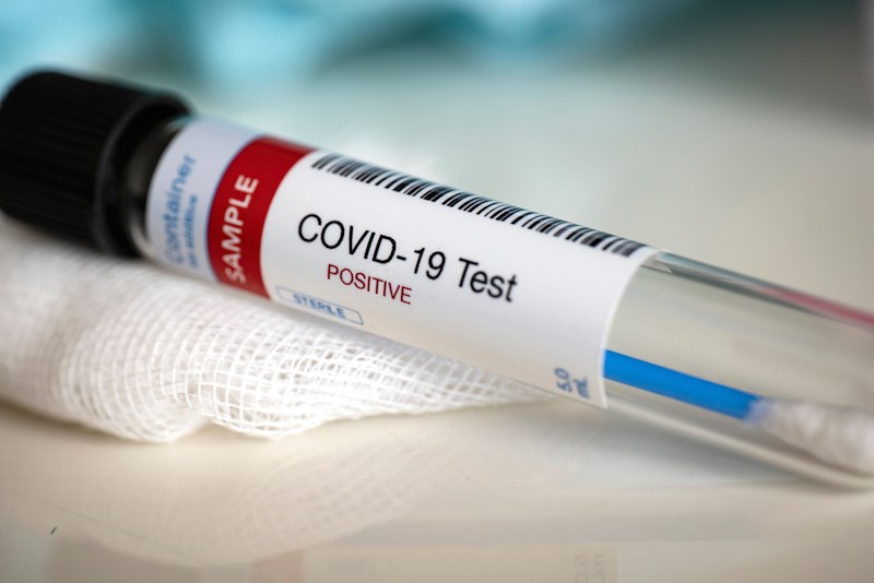 Coronavirus : 1.242 cas confirmés au Maroc
