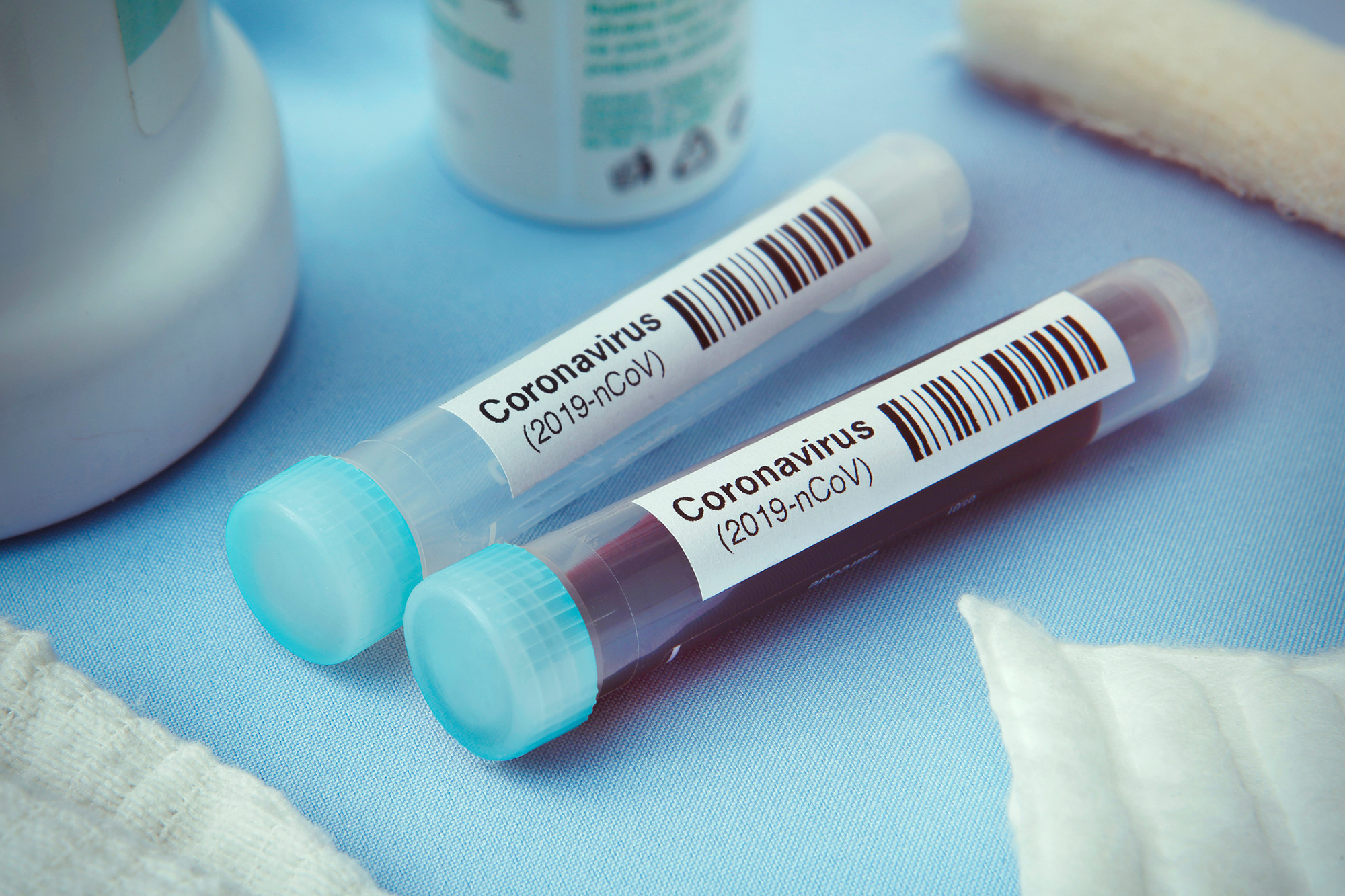 Coronavirus : 124 nouveaux cas au Maroc et 22 guérisons de plus