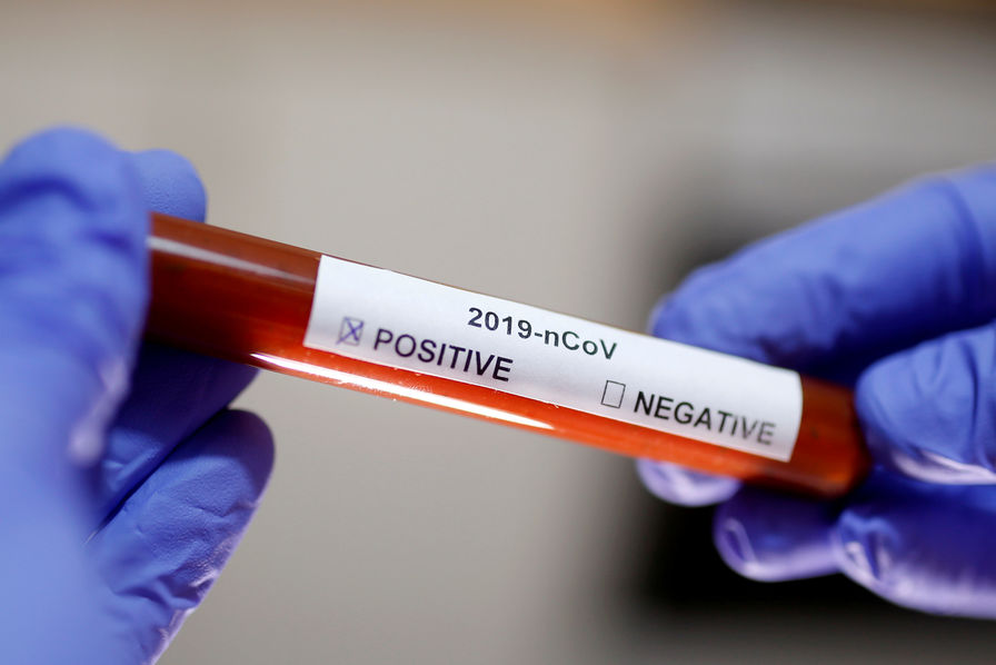 Coronavirus : Le bilan grimpe à 3.897 cas confirmés, 39 guérisons de plus