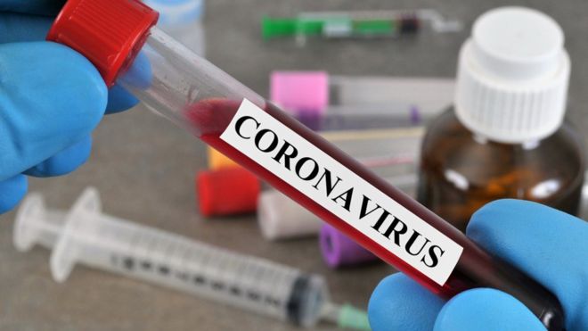 Coronavirus Maroc : 69 nouveaux cas d'infection et 150 guérisons en 24 heures