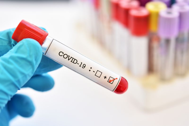 Coronavirus Maroc : 151 nouveaux cas et 168 guérisons ce dimanche 3 mai à 10 H