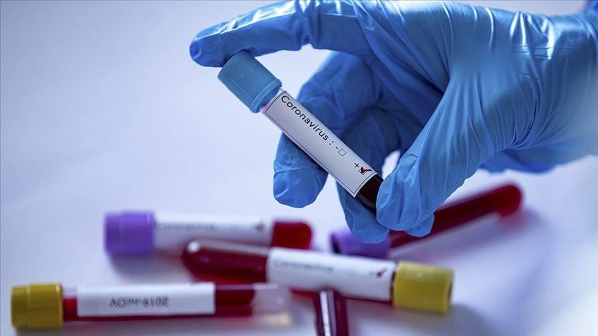 Coronavirus Maroc : 135 nouveaux cas ce mardi 9 juin à 18h