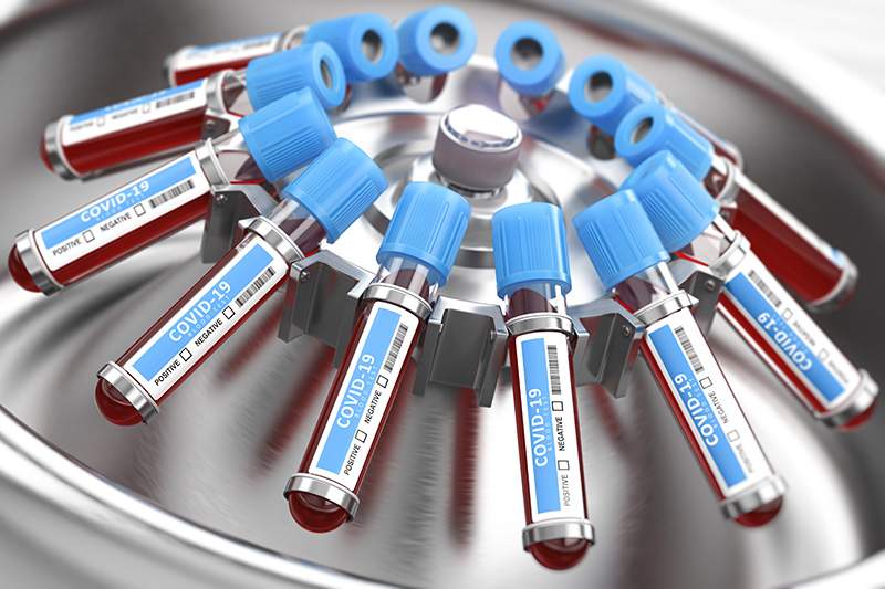 Coronavirus Maroc : 44 nouveaux cas ce vendredi à 10H, le bilan monte à 8.581 contaminations