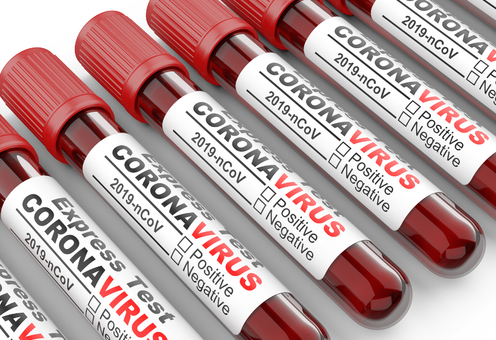 Coronavirus Maroc : 45 nouveaux cas ce lundi à 10H