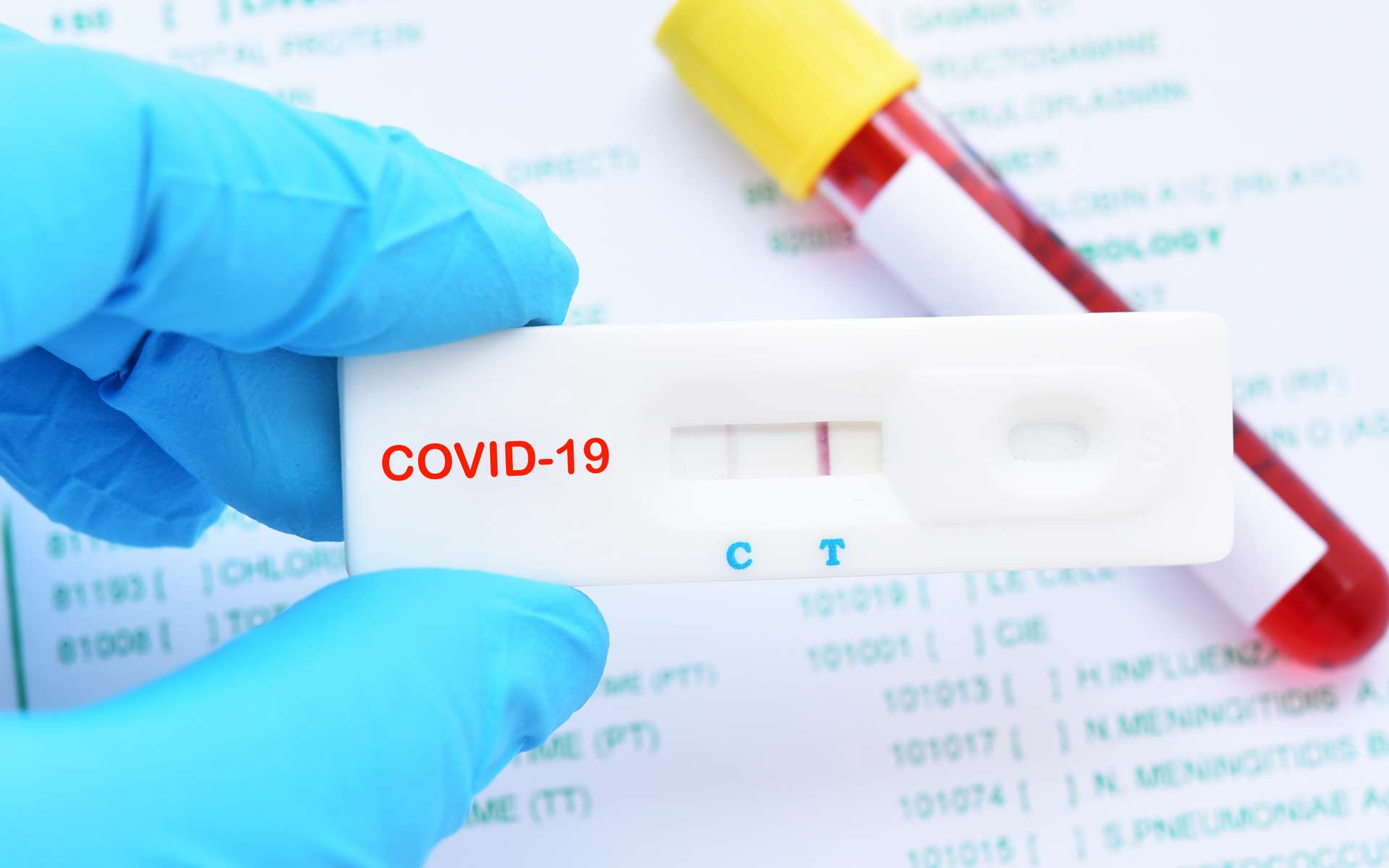 Covid-19 Maroc : Le ministère de la Santé dément l'acquisition de tests périmés
