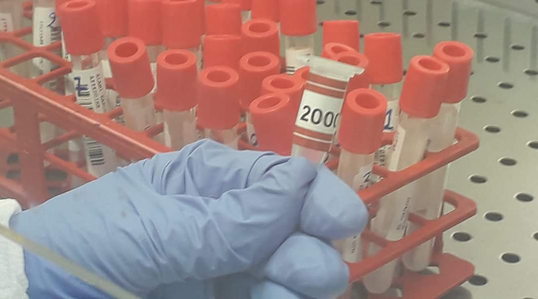Institut Pasteur/ Covid-19-Maroc : 200.000 tests effectués depuis la propagation de la pandémie