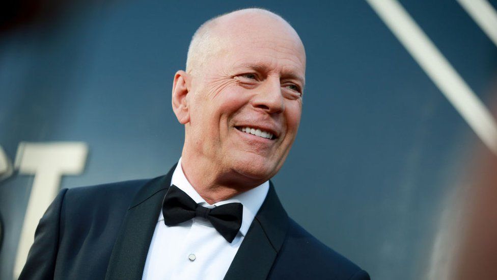 L'acteur Bruce Willis souffre d'aphasie et met fin à sa carrière
