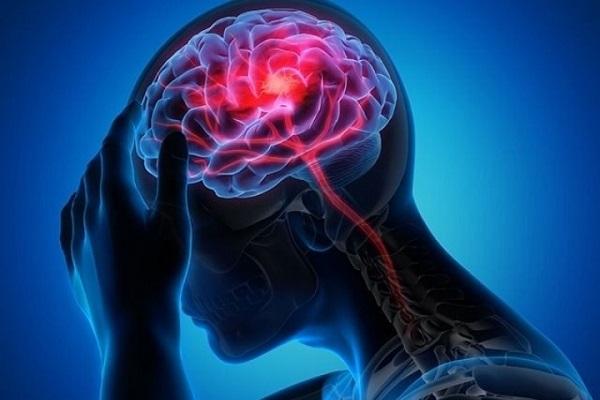 OMS : Plus d’une personne sur trois souffre de troubles neurologiques